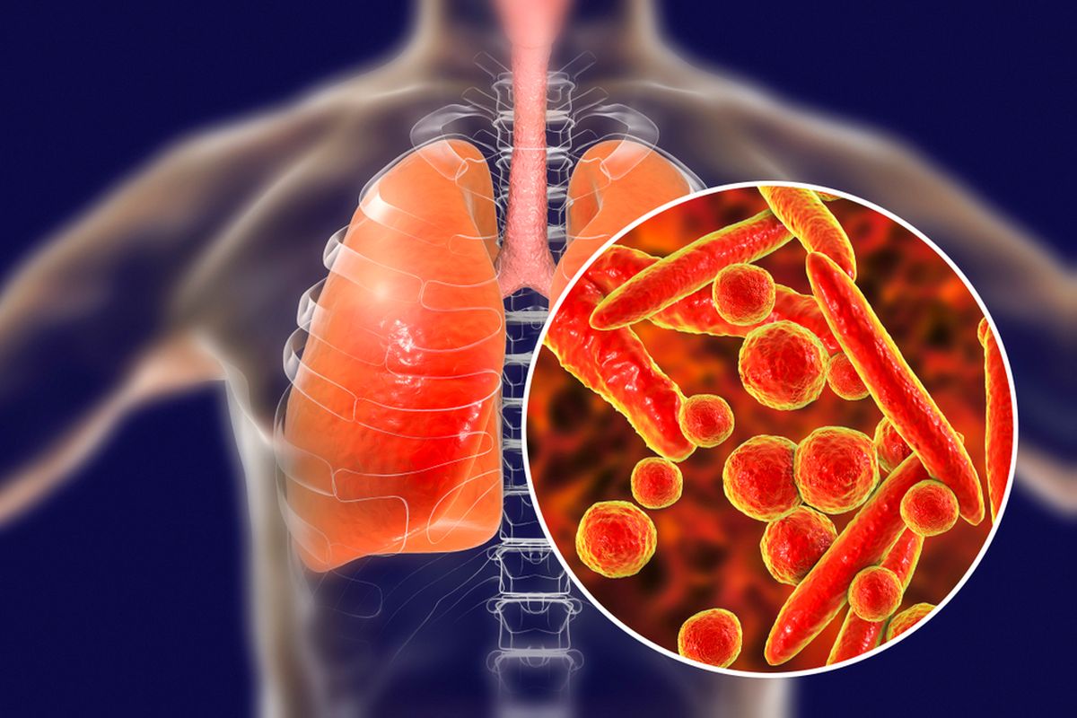 JAKARTA,coronatalk.org - Kementerian Kesehatan (Kemenkes) menyatakan, mycoplasma pneumoniae bukan penyakit yang muncul baru-baru ini. Mycoplasma pneumoniae sudah ada sejak lama, bahkan sebelum pandemi virus corona melanda.