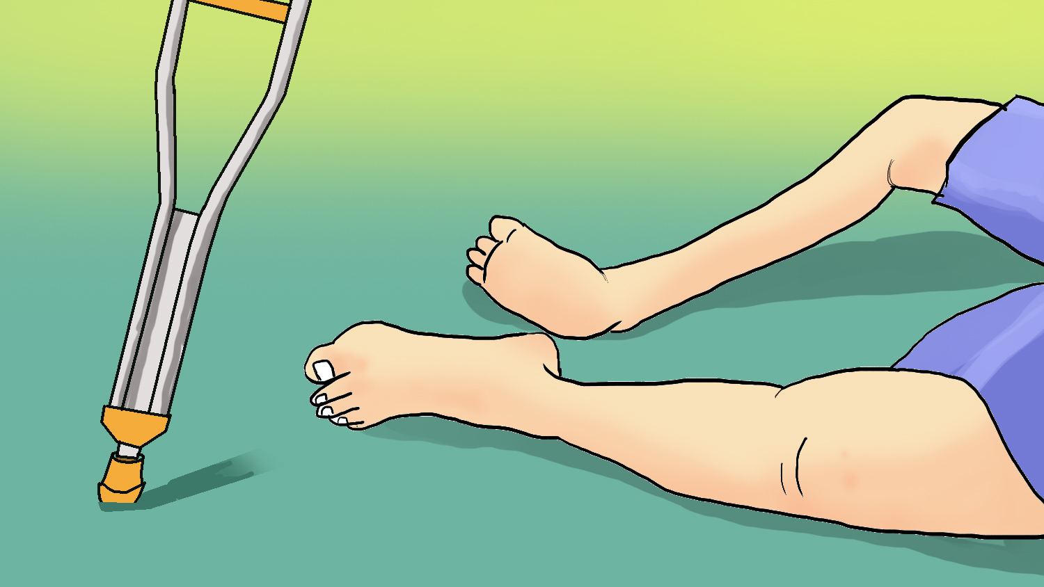 Polio, atau poliomyelitis, adalah penyakit menular yang disebabkan oleh virus poliovirus. Meskipun telah ada vaksin yang efektif dan program imunisasi besar-besaran di berbagai negara, ancaman polio tetap nyata dan jangan pernah dianggap remeh.